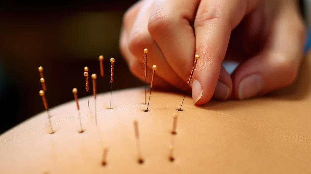 Acupuncture for Women's Health Balancing Hormones and Enhancing Fertility